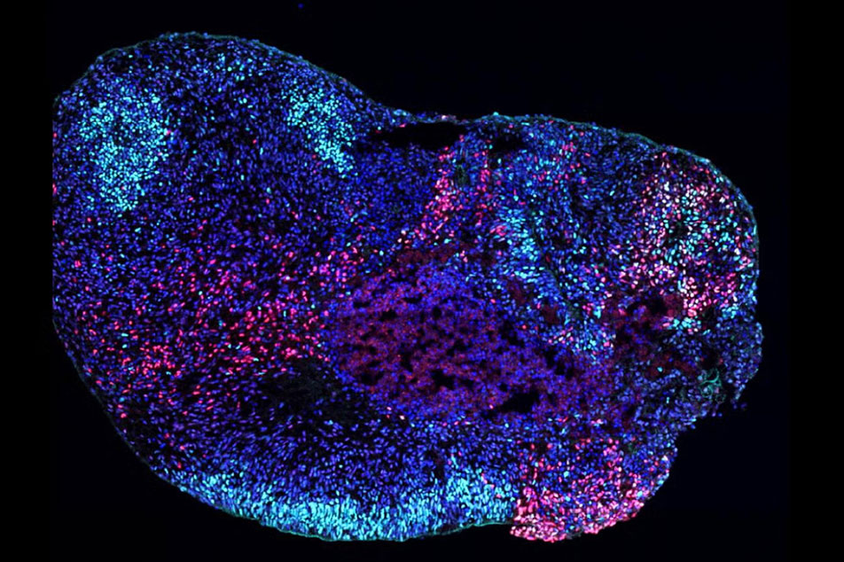 Microscopy image of a human stem cell-derived hippocampal organoid with blue, purple and pink materials